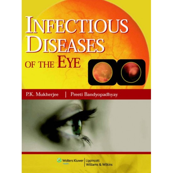 Infectious diseases of the Eyes 1st Edition