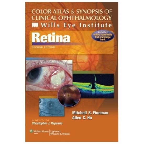 Color Atlas and Synopsis of Clinical Ophthalmology 2nd Edition